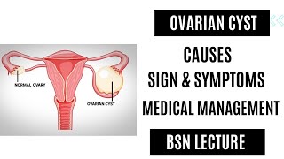 Define ovarian cyst clinical manifestation and medical management nursing lecture [upl. by Hoashis]