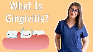 What Is Gingivitis  How To Treat Gingivitis [upl. by Leede879]