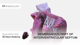 Membranous part of interventricular septum [upl. by Darline]