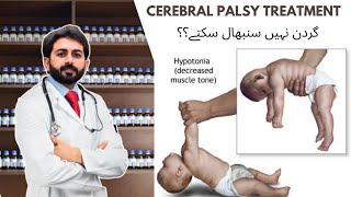 If child cannot hold his neck  Cereberal Palsy Management Homeopathic Treatment HealerZ [upl. by Kirshbaum]