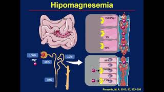 Simposio inhibidores de bomba de protones Unidad de gastroenterología [upl. by Nicholas239]