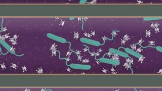 Explainer How does cholera affect your body [upl. by Sevein107]