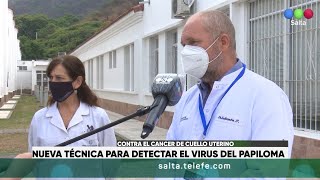 Nueva técnica para detectar el virus del papiloma [upl. by Esdnil]