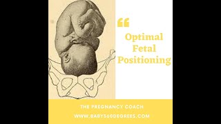 Optimal Fetal Positioning [upl. by Aihtiekal12]