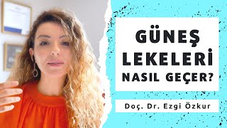 Güneş Lekeleri Nasıl Geçer Adan Zye Güneş Lekesi İçerikleri [upl. by Rehnberg]