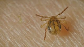 A Tickborne disease has been found in Connecticut [upl. by Ikeda]