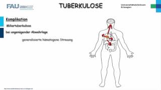 Pathologie ─ Tuberkulose [upl. by Ettenad]