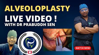 Dr Rudra Mohan  ALVEOLOPLASTY PROCEDURE LIVE  Preprosthetic Surgery  Smoothening Rough Jaw Bone [upl. by Adar107]