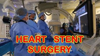 Heart Stent Surgery [upl. by Myo]