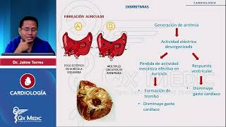 FIBRILACIÓN AURICULAR ArritmiasINDICE DESCRIPCIONFISIOPATOEKG CARDIOLOGÍA QX MEDIC ENAM [upl. by Valery]