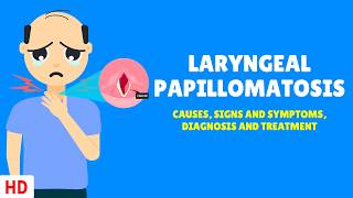 LARYNGEAL PAPILLOMATOSIS Causes Signs and Symptoms Diagnosis and Treatment [upl. by Hamish]