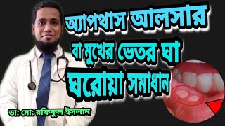 অ‌্যাপথাস আলসার এর ঘ‌রোয়া সমাধান  Aphthous ulcer in Bangla [upl. by Esiralc]