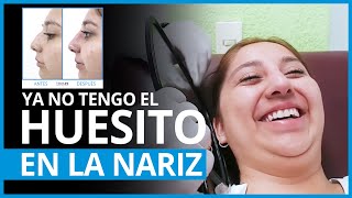 6 CAUSAS más comunes de OBSTRUCCIÓN NASAL y como resolverlo  PlasticFacial MX [upl. by Duvall312]