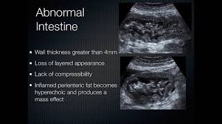 Gastrointestinal Genitourinary  GI GU Ultrasound [upl. by Sianna974]