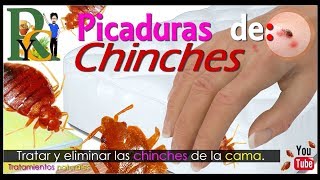 🕷️🐛 Picaduras de chinches  Piquetes de chinches  Como eliminar chinches de la cama picaduras 🛏️ [upl. by Aliehs]