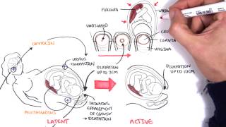 Obstetrics  Stages of Labour [upl. by Pellegrini]