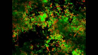 Imagen en movimiento de biofilms orales Moving image of biofilms Europerio 7 [upl. by Benton]