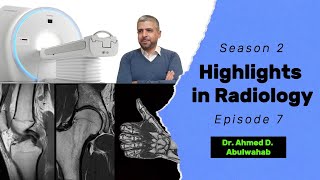 Highlights in Radiology S2 E7 Subacromial impingement Supraspinatus impingement [upl. by Gean]