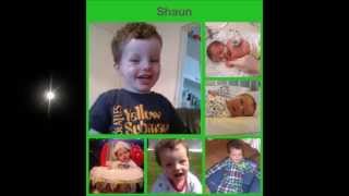 Rare Chromosome Disorder T8M Trisomy 8 Mosaic Syndrome [upl. by Sucramd181]