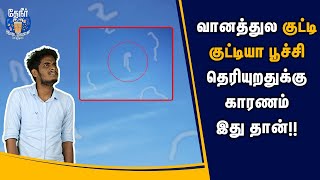 குட்டியா பூச்சி மாதிரி உங்க கண்ணுக்கு தெரியுறதுக்குக் காரணம் இது தான்  Floaters in Tamil [upl. by Somerset]