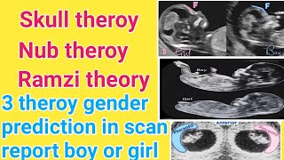 Ramzi theory Skull theroy Nub theroy gender reveal full details in tamil [upl. by Nnylrahc]