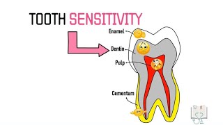 Theories of Dentin Sensitivity Hypersensitivity [upl. by Anisah912]