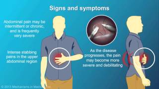 Chronic Pancreatitis [upl. by Joo]