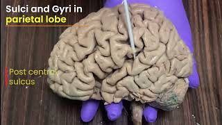 Brain Part 4 Sulci and Gyri in superolateral surface of brain [upl. by Aoht610]