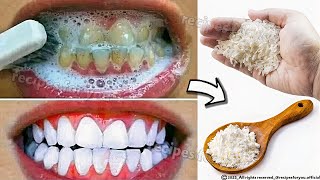 Teeth whitening at home in just 2 minutes  how to whiten teeth at home 100 effective [upl. by Noicpecnoc]