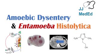 Amebiasis Amoebic Dysentery  Entamoeba histolytica Pathogenesis Signs amp Symptoms Treatment [upl. by Nalloh]