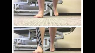 Kinesiology Rocktape to correct over pronation [upl. by Nosnirb]