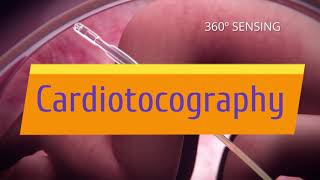 Cardiotocography Trailer [upl. by Tersina444]