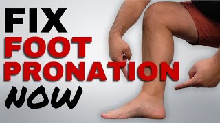 Correct Foot Pronation with these 5 Essential Running Exercises [upl. by Riehl]