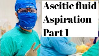 Ascitic fluid aspirationFor therapeutic purpose [upl. by Yellac]