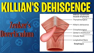 Killians Dehiscence Zenkers Diverticulum head anatomy anatomy mbbs viral youtube shorts [upl. by Linkoski695]