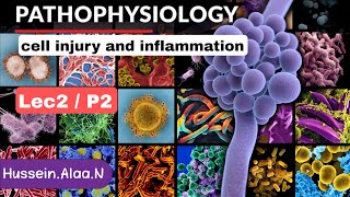 pathophysiology  L2P2 [upl. by Daffodil76]