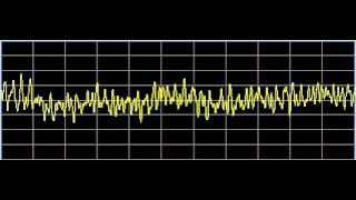 Scar Tissue  Rife Frequencies [upl. by Meri]