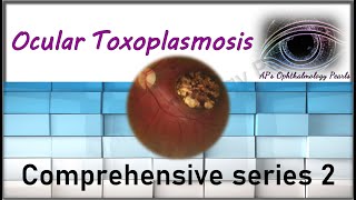 Ocular toxoplasmosis  Comprehensive series 2 [upl. by Lana118]