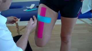 How to apply Kinesiology Taping for a strain of the Rectus Femoris  Quadricep muscle strain [upl. by Ehcram695]