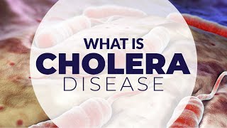 WHAT IS CHOLERA DISEASE [upl. by Haimes]