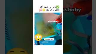 طريقة صحراوية لاخراج البرد من الظهر والجسم [upl. by Wina]