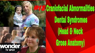 Craniofacial amp Dental Syndromes INBDE Dental Boards [upl. by Netsud809]