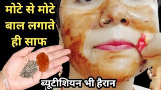 होठों के ऊपर के बाल को आने से कैसे रोके🤔 चेहरे के बाल कैसे हटाए  facial hair treatment in Hindi [upl. by Tannenwald]