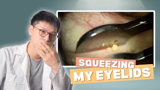 Squeezing my eyelids was SATISFYING [upl. by Laura]