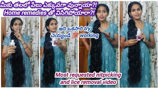 ఇక తలలో పేలకీ చెప్పండి bye bye👋 Best remedy to remove nits and hair lice haircare nitspicking yt [upl. by Still]