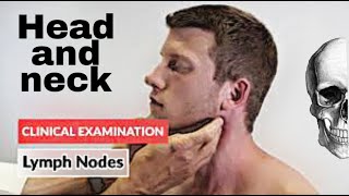 Clinical Examination  Head and Neck Lymph nodes [upl. by Anyale]