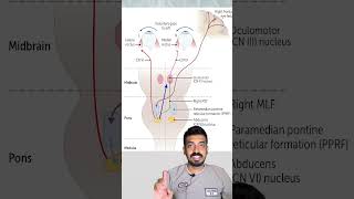 Internuclear Ophthalmoplegia concept explained in 3minutes [upl. by Siekram]