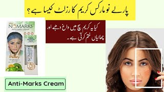 Parley No Marks Cream Review  Skin whitening cream  Anti Marks Cream [upl. by Lewin]