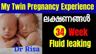 Twin Pregnancy Experience Malayalam  Twin Pregnancy Symptoms Before Period Malayalam [upl. by Hugon811]