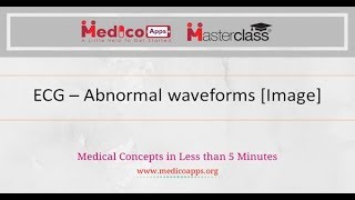 ECG – Abnormal Wave forms Image [upl. by Odnuges]